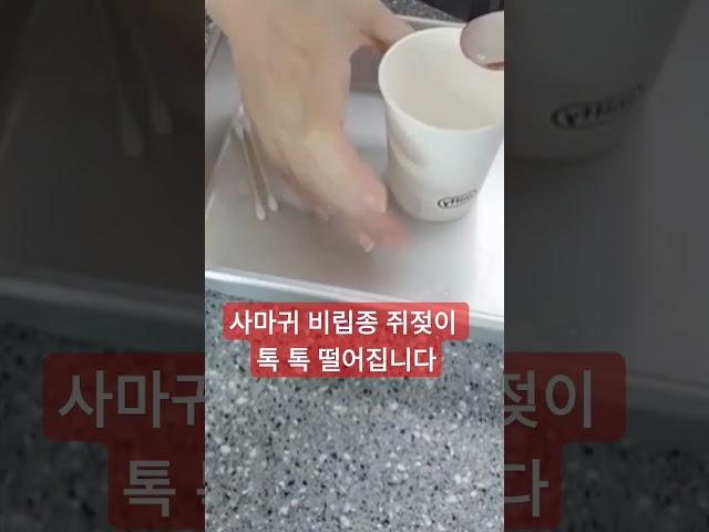 쥐젖 사마귀 편평사마귀 검버섯 바르고 자면 뚝 떨어지는/꿀팁/