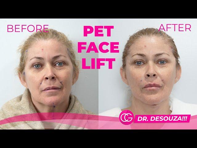 PET FACE LIFT - FULL PROCEDURE AND TESTIMONY! - CG Cosmetic surgery