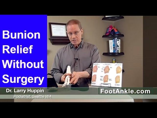 Don't Have Bunion Surgery Until You Watch This -- Podiatrist Explains How to Avoid Bunion Surgery