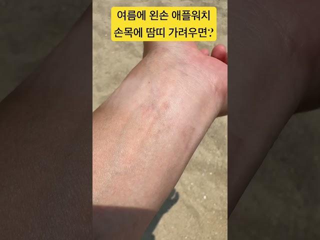 여름에 왼손 Apple Watch 손목 땀띠 나서 가려울때 ?