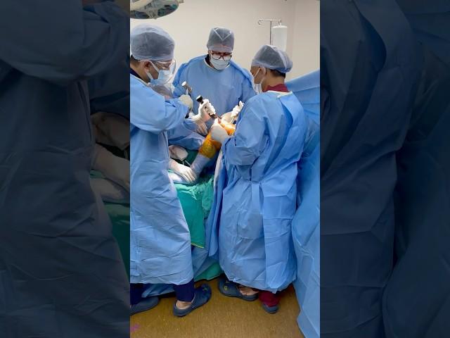 knee replacement OT-it takes Precision & power in fitting a new knee #totalkneereplacement