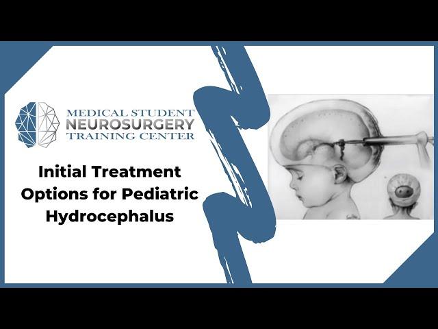 Initial Treatment Options for Pediatric Hydrocephalus