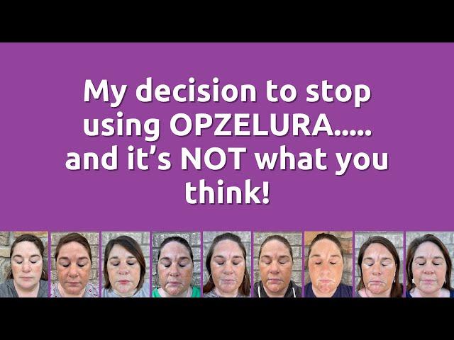 My decision to stop using OPZELURA.....and it’s NOT what you think!