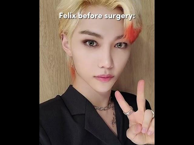 Felix before surgery  #straykids #shorts