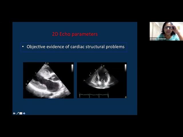 45 Course , 20220619 Diastolic Function by Dr Debika Chhaterjee