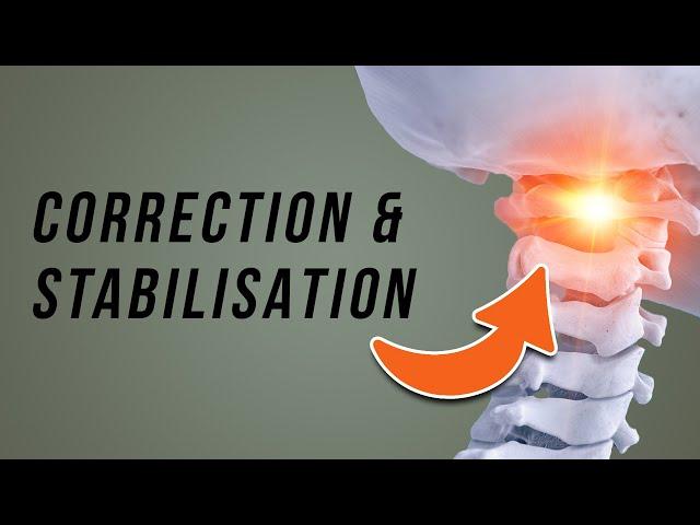 ATLAS Misalignment // Upper Cervical Instability Exercises