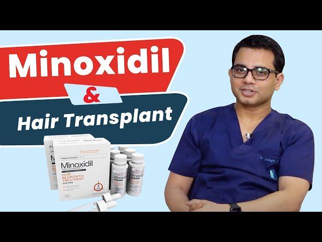 Do I need to take Minoxidil After Hair Transplant? | Best Hair Transplant Surgeon- Dr.Jangid | Delhi