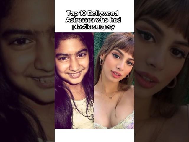 Top 10 bollywood actresses who had plastic surgery.#shortvideo#videotop10 #actress#video