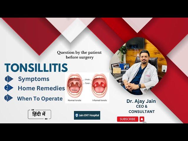 Tonsils (symptoms, home remedies, surgery ) (हिंदीं)(Dr Ajay Jain)