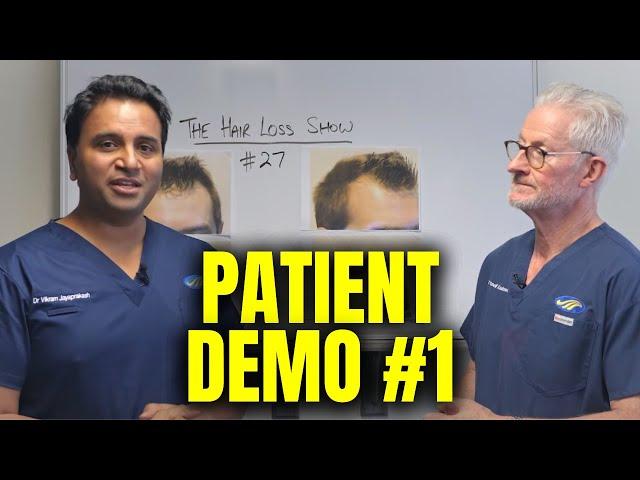 Patient Demonstration of Male Pattern Hair Loss