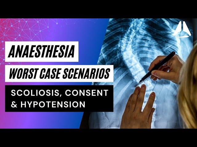 Scoliosis, Consent and Hypotension | Anaesthesia Worst Case Scenarios #anesthesiology #anesthesia