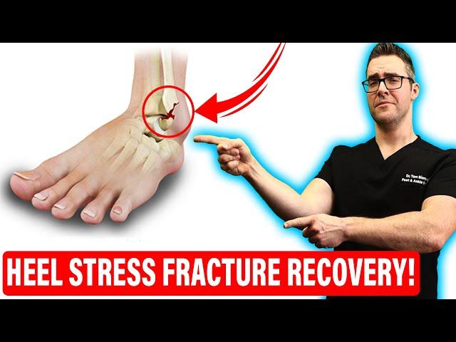 Calcaneus Stress Fracture Treatment [Heel Stress Fracture RECOVERY!]