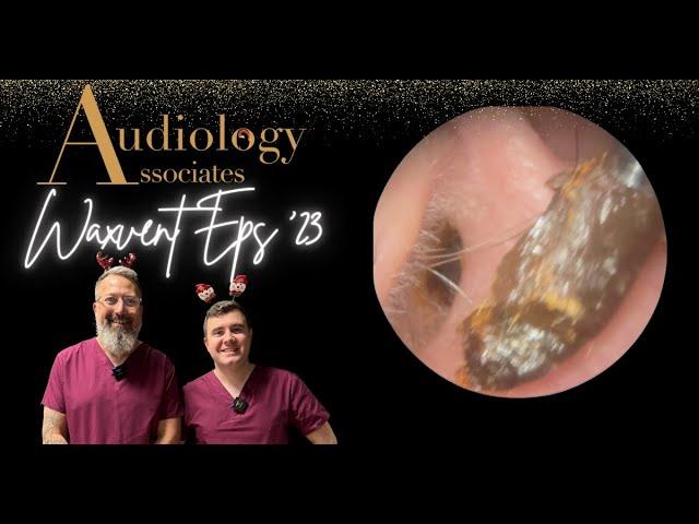 EASY EAR WAX PLUG REMOVAL - WAXVENT 23