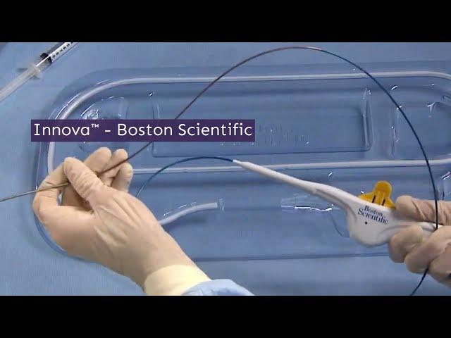 Sistema de Stent Innova para intervencionistas vasculares - MedCia - Boston Scientific