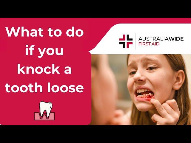 What To Do if You Knock a Tooth Loose