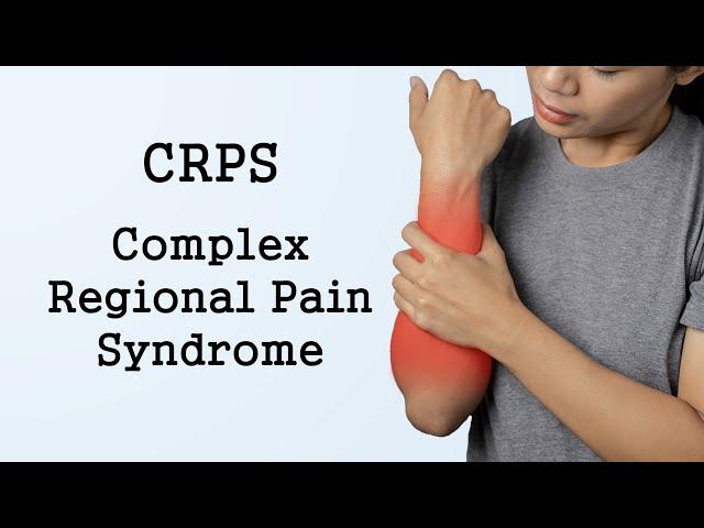 Complex Regional Pain Syndrome (CRPS)