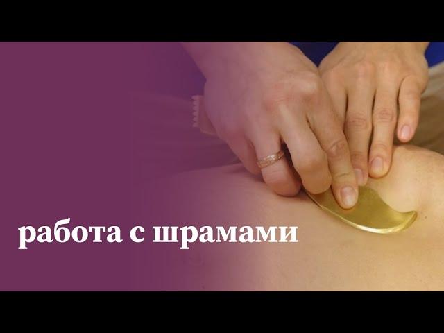 МАМР: Методики работы со шрамами и отеками | Лечение шрамов и отеков | МАМР