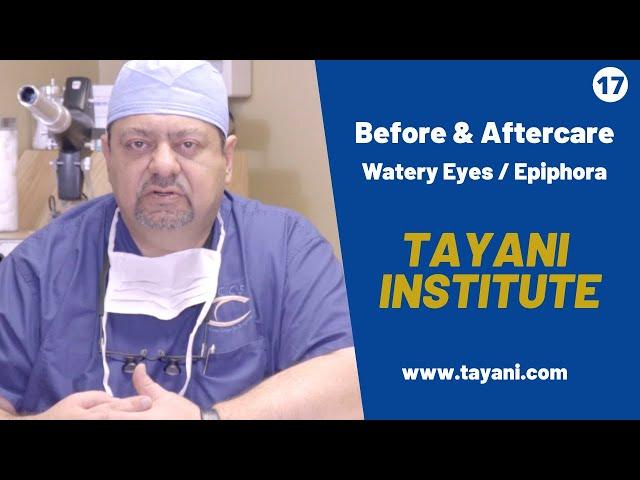 What Causes Watery Eyes? | With Dr. Tayani