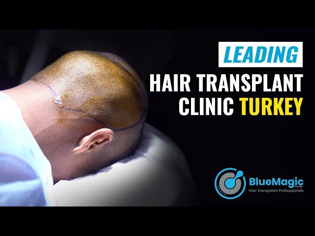 Leading Hair Transplant Clinic Turkey | BlueMagic Group International