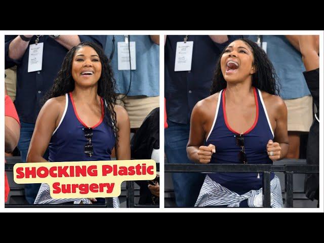 SHOCKING: Gabrielle Union Gets Plastic Surgery - Now She's Looks Unrecognizable!!