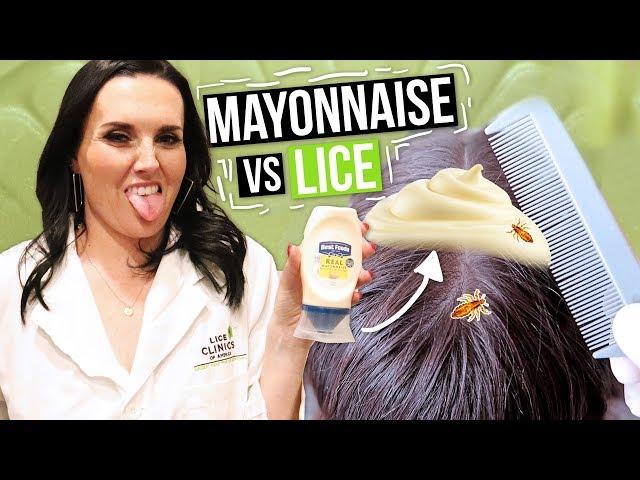 Removing LICE with MAYONNAISE!!? Watch this before you try!