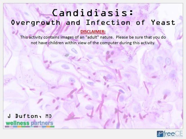 Candidiasis: Overgrowth and Infection of Yeast