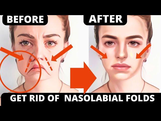 Smooth Laugh Lines & Nasolabial Folds Naturally with Face Yoga | No Botox, No Fillers!