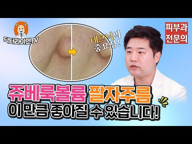 쥬베룩볼륨 팔자주름 효과 얼마나 좋아질까? "테크닉의 중요성"