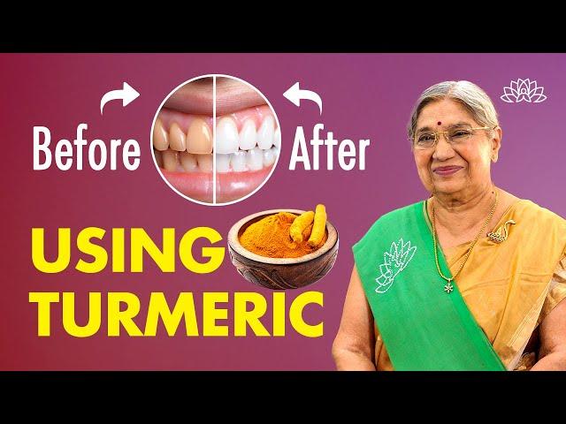 Teeth Whitening at Home| Ayurvedic Turmeric/Haldi Remedy for Brighter Teeth| Natural Oral Care Tips