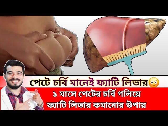 ১ মাসে পেটের চর্বি গলিয়ে ফ্যাটি লিভার কমানোর ঘরোয়া উপায় | The 8 Best Way To Heel A Fatty Liver