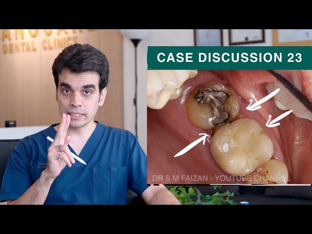 Food Impaction - Case Discussion 23