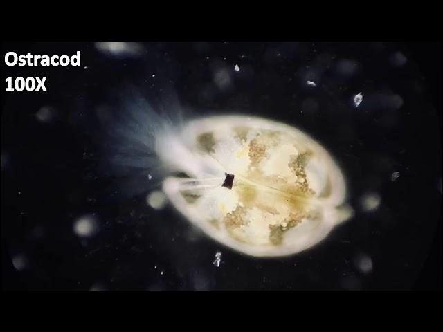 MY JOURNEY to the MICROCOSMOS - Ep.2