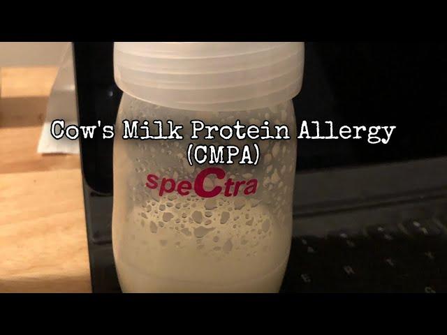 Cow Milk Protein Intolerance (CMPA) and Breastfeeding