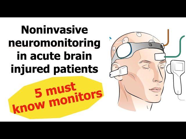 5 Noninvasive neuromonitoring in Neuro ICU: That you must know