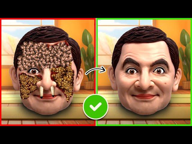 ASMR Remove Kendrick Ticks And Maggots From Mr Bean | Severely Injured Treatment Animation