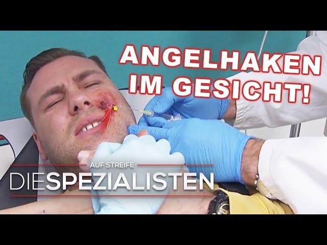  Gefährlicher Fang: Angelhaken bohrt sich ins Gesicht! | Die Spezialisten | SAT.1