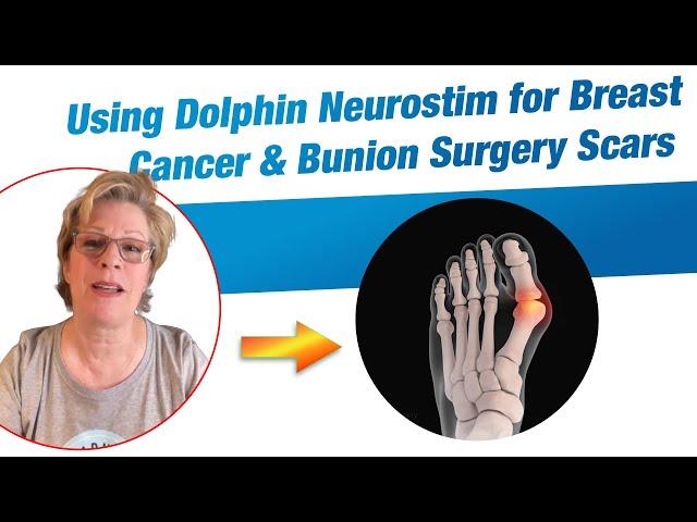 Marney Thomas (MT) | Testimonial | Dolphin Neurostim