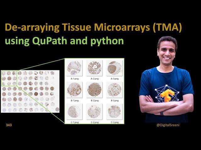 343 De-arraying Tissue Microarrays (TMA) using Qupath and python code