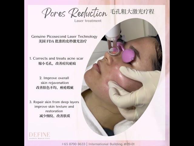 Pico Fractional 改善痘坑 | Define Aesthetic Medical Clinic