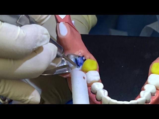 Third Molar Removal Hands-on Training