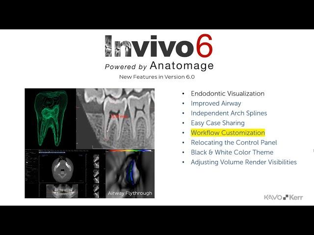 Invivo 6™ Tutorial - New Features in Invivo™ 6