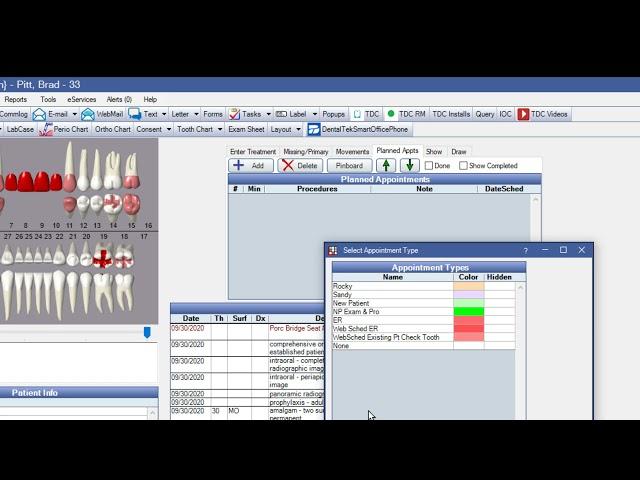 Open Dental Scheduling with Appointment Types