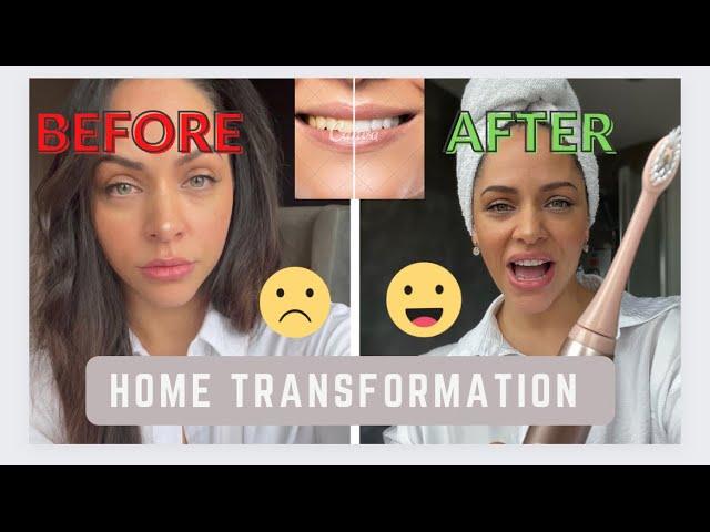 How to whiten your teeth at home! Plus unboxing Ordo Sonic+ toothbrush!