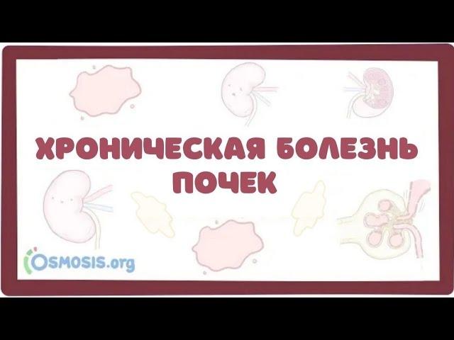 Хроническая Болезнь Почек (ХБП, ХПН) - причины, симптомы, клиника, лечение (лекция)