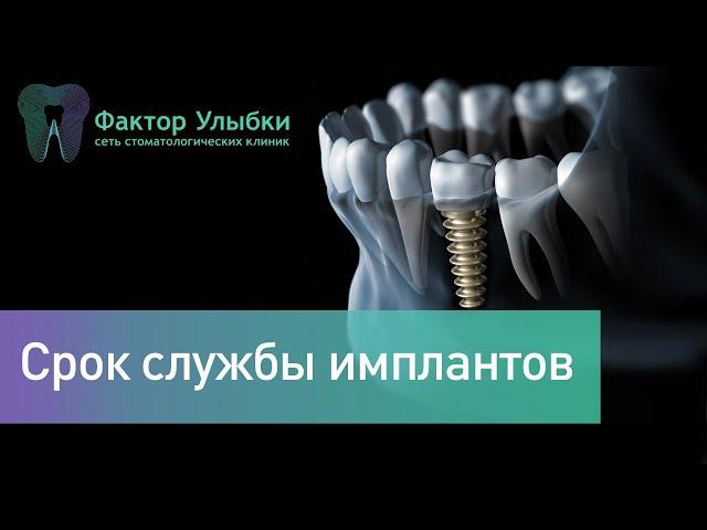 Какой срок службы имплантов? Что влияет на срок службы имплантата?