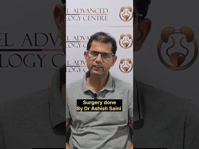 Drug coated balloon dilatation(optilume) for urethral stricture review