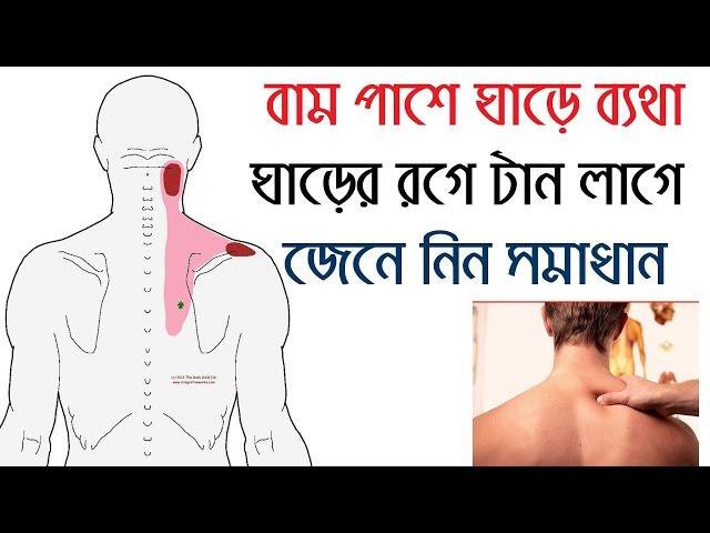 বাম পাশে ঘাড়ে ব্যথা করে, ঘাড়ের রগে টান লাগে, জেনে নিন সমাধান