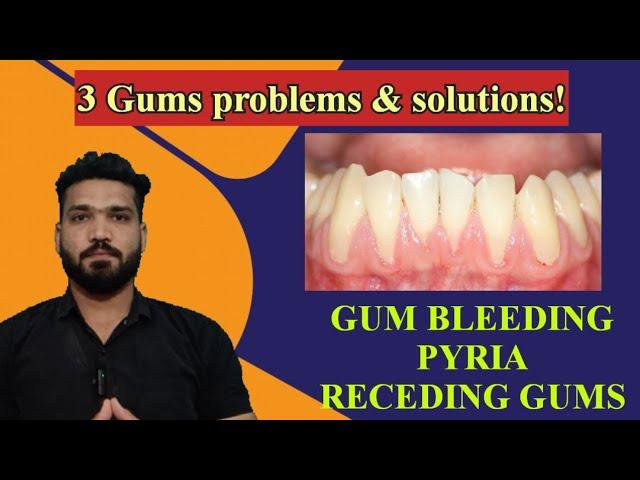 3 gums problems and solution at home & clinic