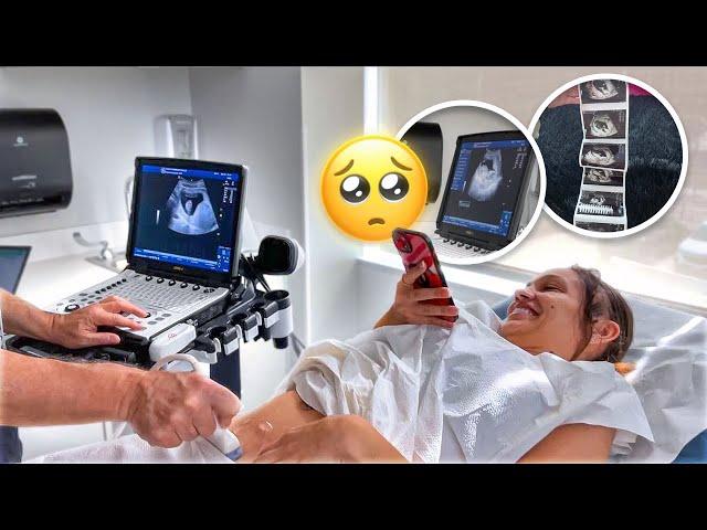 FIRST Ultrasound + Hearing The HEARTBEAT *emotional*