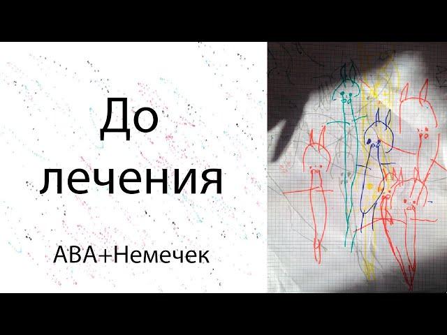 Аутизм РАС. До лечения
